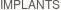 Dentist Greensboro Implants